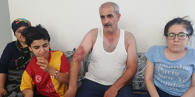 Engelli kız ve babasına akrabalarından 'Bana niye oy vermedin' dayağı
