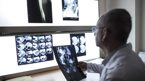 Epilepsi tedavi edilebilir mi?