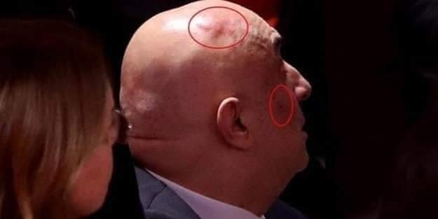 Erdoğan'a hakaret eden CHP'li Engin Özkoç'u o AK Partili mi benzetti?