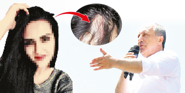 Erdoğan'ı öven kızın saçlarını yoldular