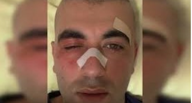 Erdoğan’ı tehdit eden PKK’lı Avrupa ülkesinde yaka paça gözaltına alındı! İnanılmaz detaylar ortaya çıktı