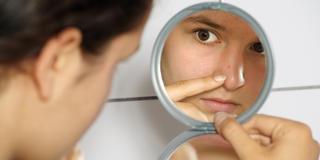 Ergenliğin en önemli cilt sorunu: Akneler…