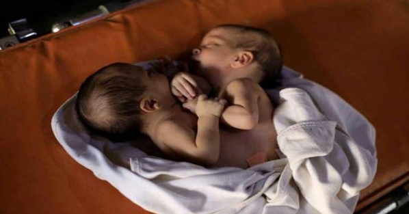 Esed bu ikizleride katletti!