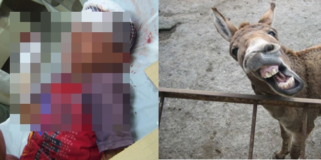 Eşeğin ısırdığı çocuk hastanelik oldu