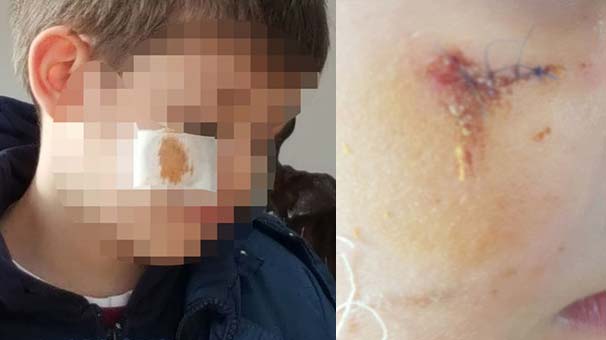 Esenler'de ilkokulda öğrenciye darp söylentisi