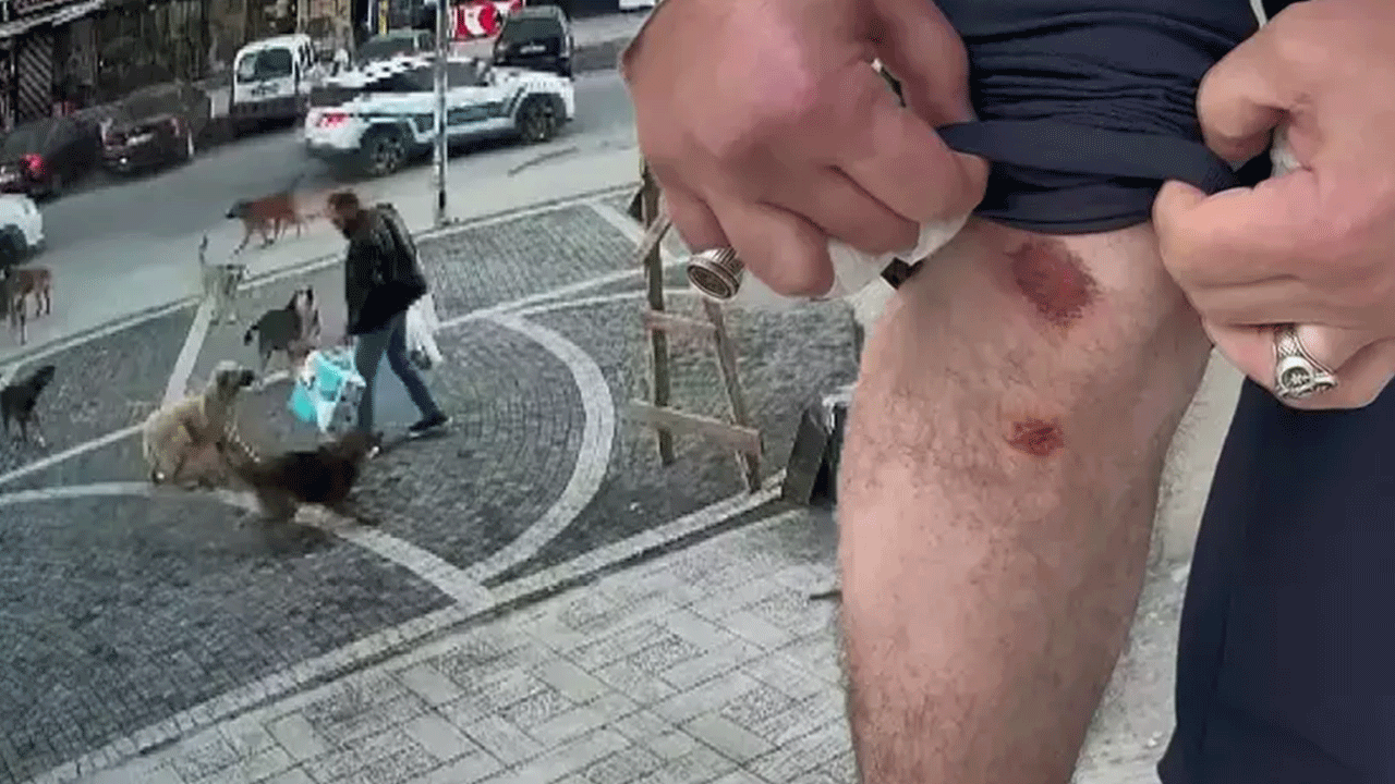 Esenyurt'ta sokakta serbest bırakılan köpek misafirlere saldırdı! apartmanda kavga çıktı