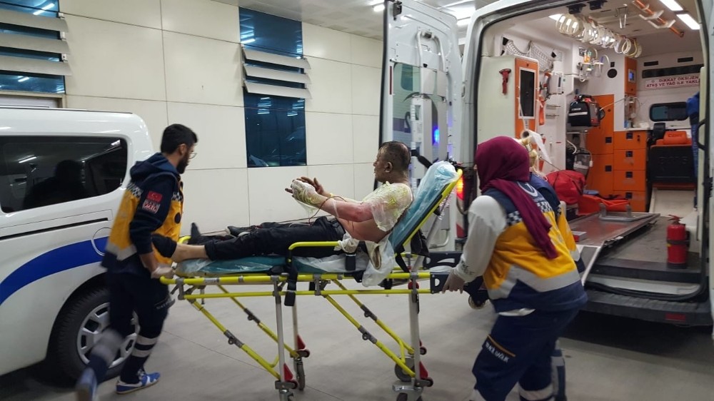 Eşi barışma teklifini kabul etmedi kendini yaktı 