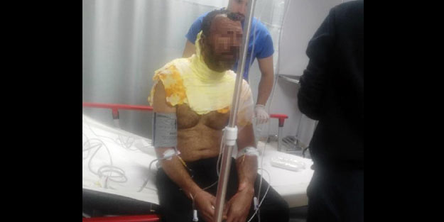 Eşine kızıp kendini yaktı, 'İnandırmak için yaptım' dedi