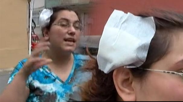 Eşine tuz ruhu dökerek silah kabzasıyla başına vuran sanığa 1,5 sene hapis