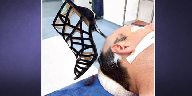 Başına öyle bir şey saplandı ki...