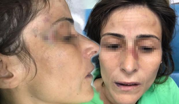 Eşinin kemiklerini kıran doktora mahkemeden şaşırtan ceza!
