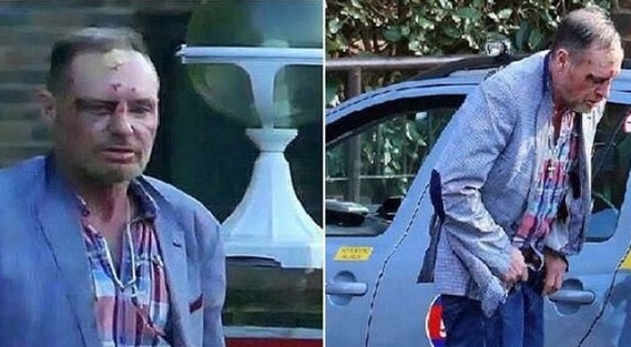 Dünya yıldızının son hali içler acısı...