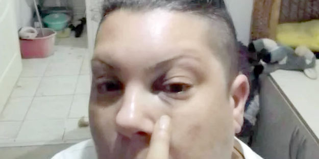 Eski Popstar yarışmacısı saldırıya uğradı!