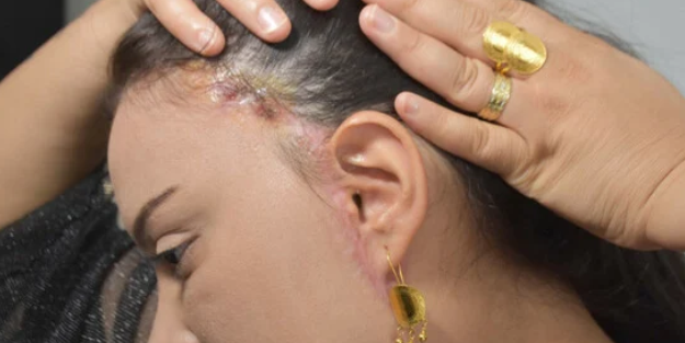 Estetik ameliyat hayatını kararttı