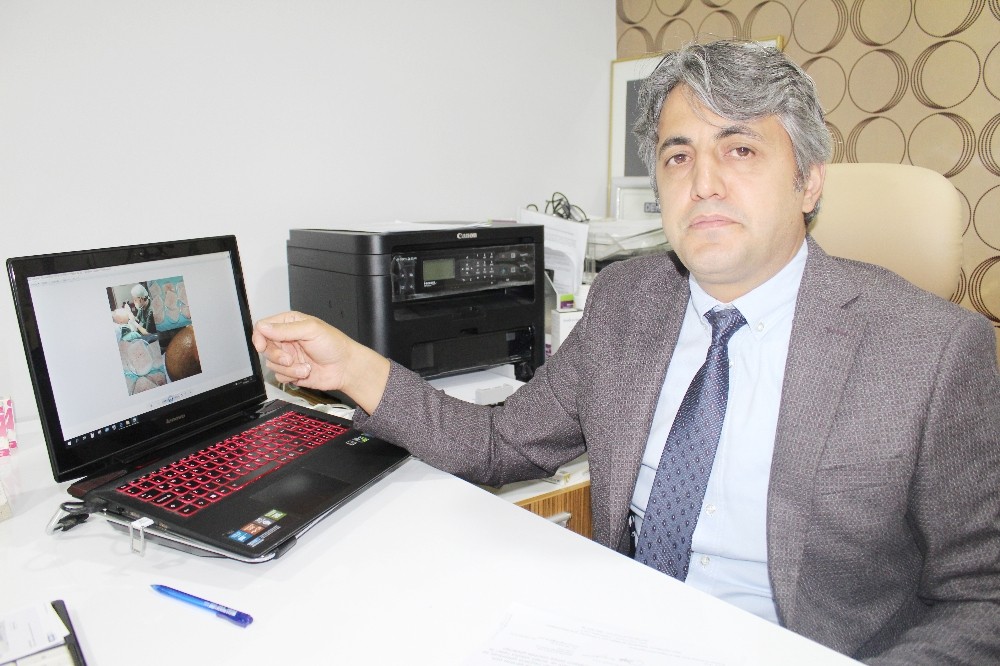 Estetik Cerrah Elmas’tan saç ekimi uyarısı 