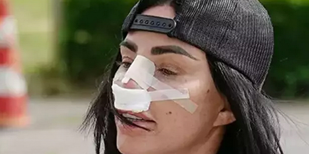 Estetik manyağı dedikleri bu olsa gerek: Bu kadarı da pes: Dikkat çeken görüntü: Kritik detay