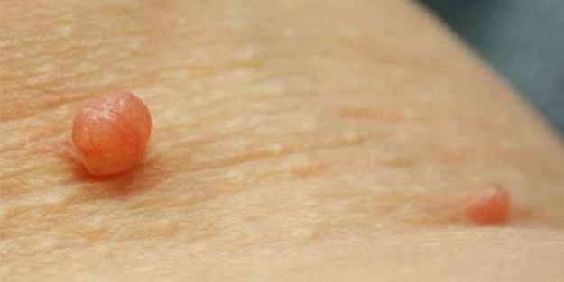 Et benlerinden kurtulmak çok kolay!