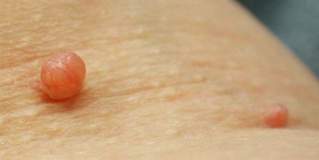 Et benlerinden kurtulmak çok kolay!