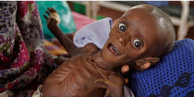 Etiyopya’da 10 milyon kişi açlığın pençesinde