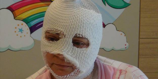 Ev hanımları dikkat! Yüzüne patladı, vücudunda yanıklar oluştu