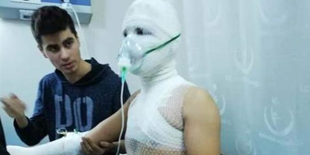 Evde yaptıkları deney, pahalıya patladı! Az kalsın ölüyorlardı