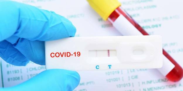 Fatih Erbakan canlı yayında paylaşmıştı! PCR test kiti ile ilgili çarpıcı belge yeniden gündemde