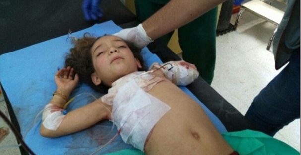 Fatma'nın kolunu kopardılar