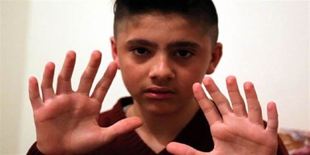 Fazla parmaklarını kestirmedi!