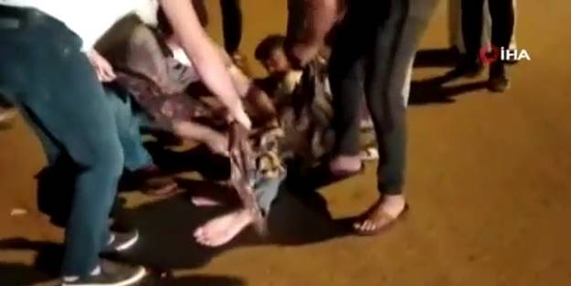 Feci kaza! Ayağının koptuğunu kimse söyleyemedi