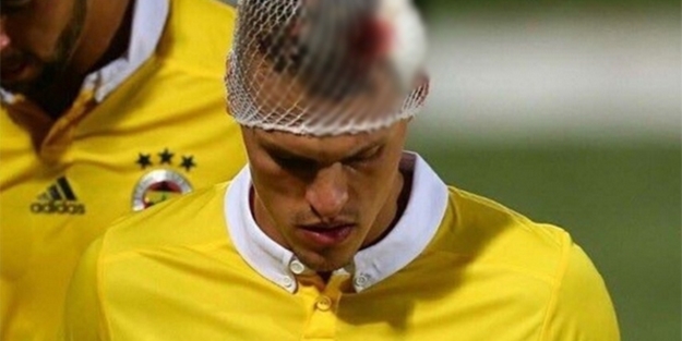 Fenerbahçeli yıldız kanlar içinde kaldı