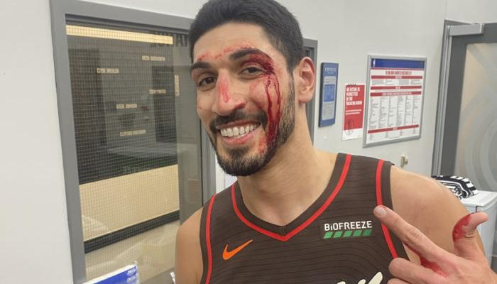 FETÖ'nün "vatansız iti" dayak yemişten beter oldu! Sağlı-sollu, Allah ne verdiyse girişti