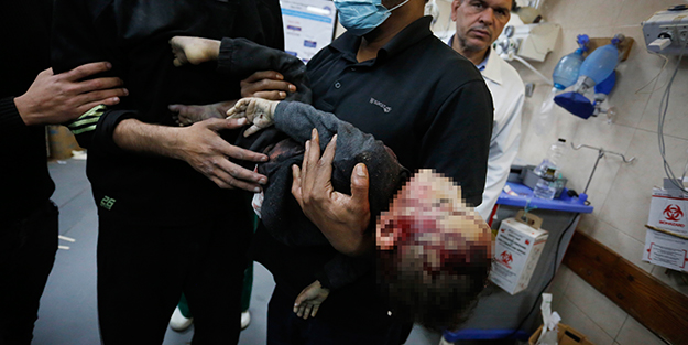 Filistin'deki vahşete dikkat çekti! 'Bebeklerin bedenlerini yiyor'