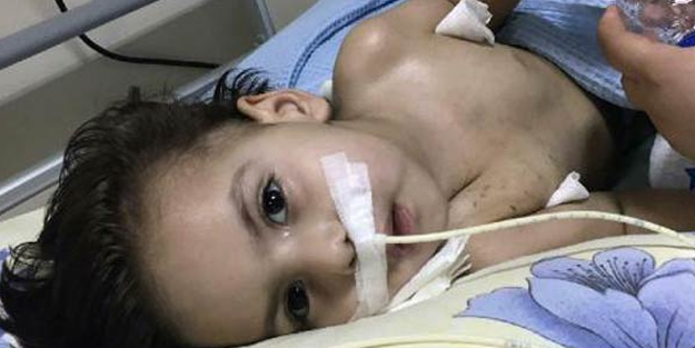 Fındık kırıntıları 3 yaşındaki Ömer'in hayatını kararttı