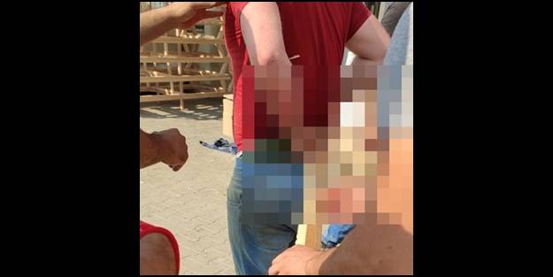 Fırlayan ağaç parçası, karnından girip sırtından çıktı!