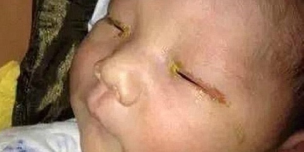 Fotoğraf makinesinin flaşı küçük bebeği kör etti