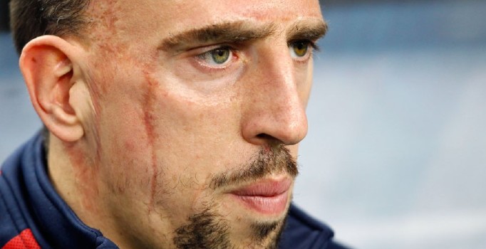 Franck Ribery: Beni görenler 'suratın ne kadar çirkin' diyor