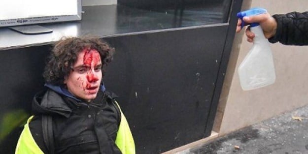 Fransa'da çatışmalar polis şiddetine dönüştü