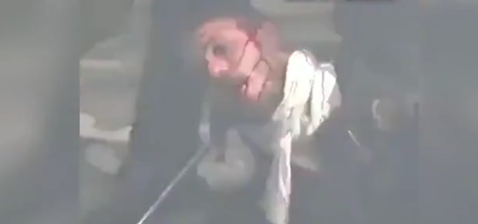 İnsanlıktan utandıran görüntüler! Döve döve bayılttılar
