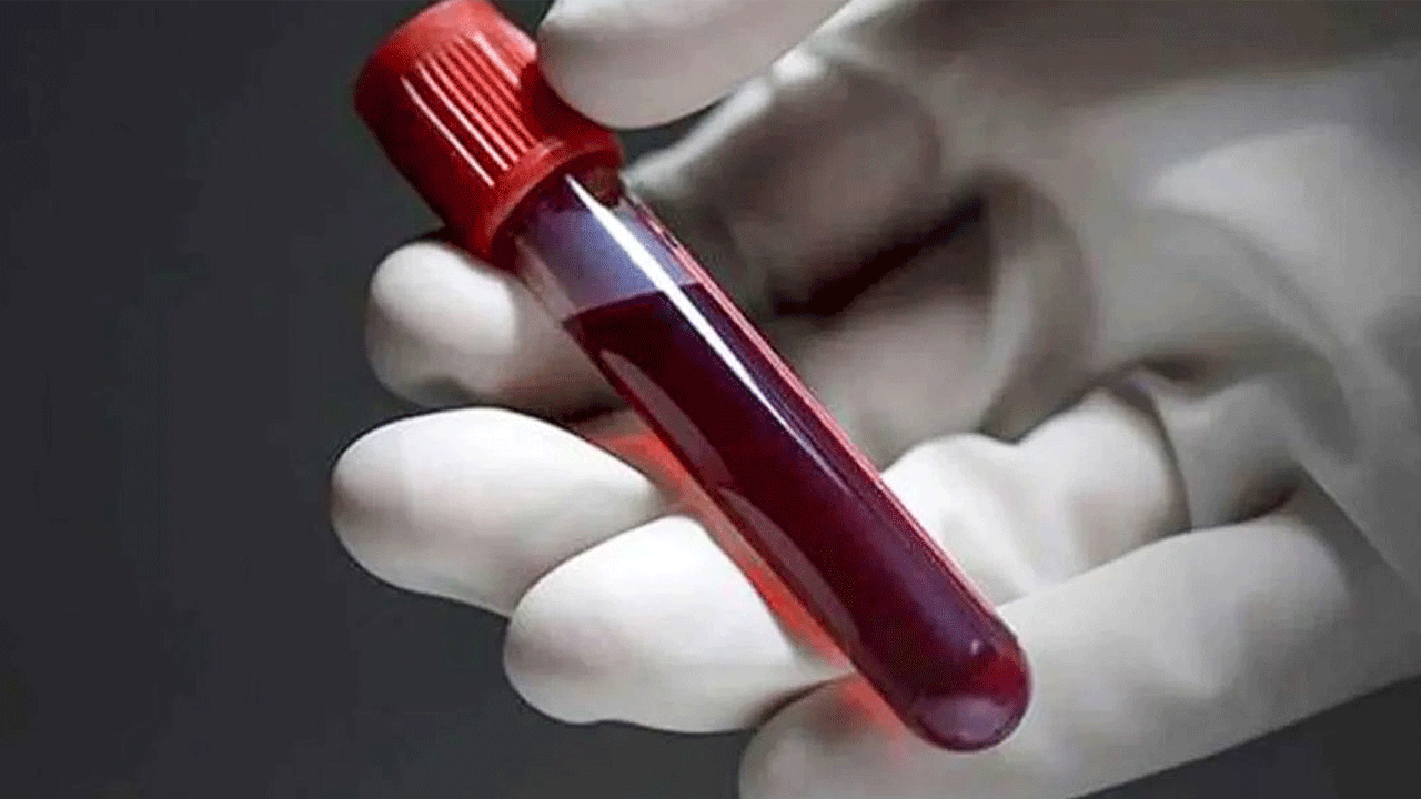 Fransız bilim adamları duyurdu: Yeni bir kan grubu keşfedildi!