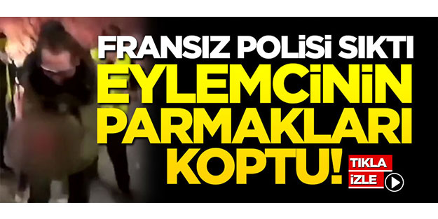 Fransız polisinin ateş açtığı eylemcinin parmakları koptu