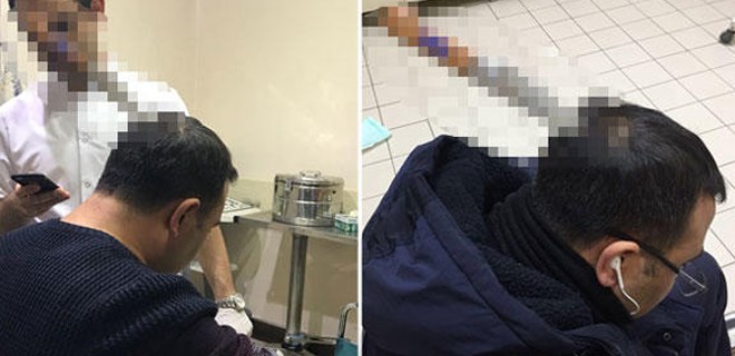 Galatasaray Lisesi'nde korkunç olay! Müdürünü kafasından bıçakladı