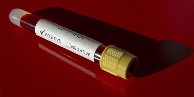 Gana Sağlık Bakanı koronavirüse yakalandı