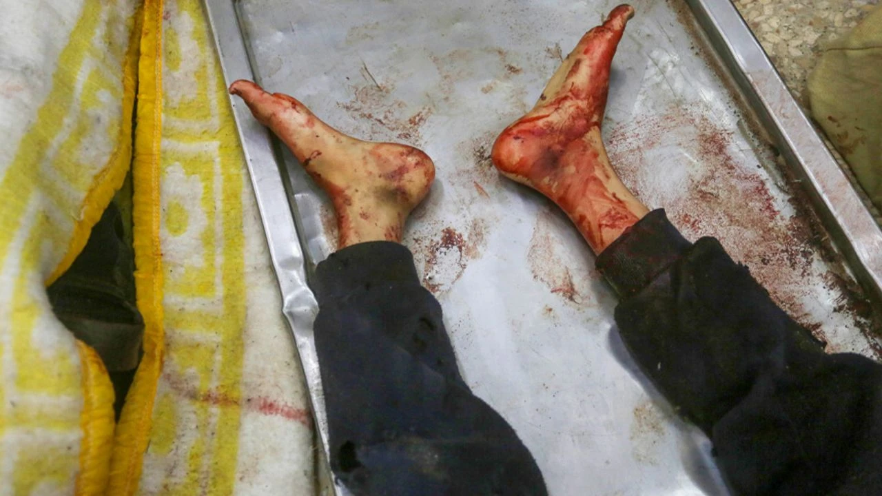 Gazze Şeridi'nde sadece 52 tane yoğun bakım yatağı kaldı!