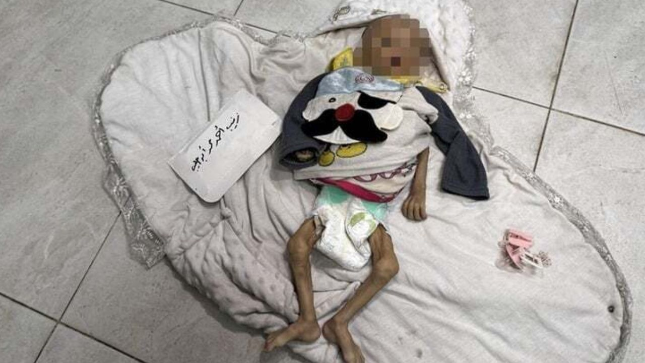 Gazze'de 24 saatte 5 kişi açlıktan öldü!