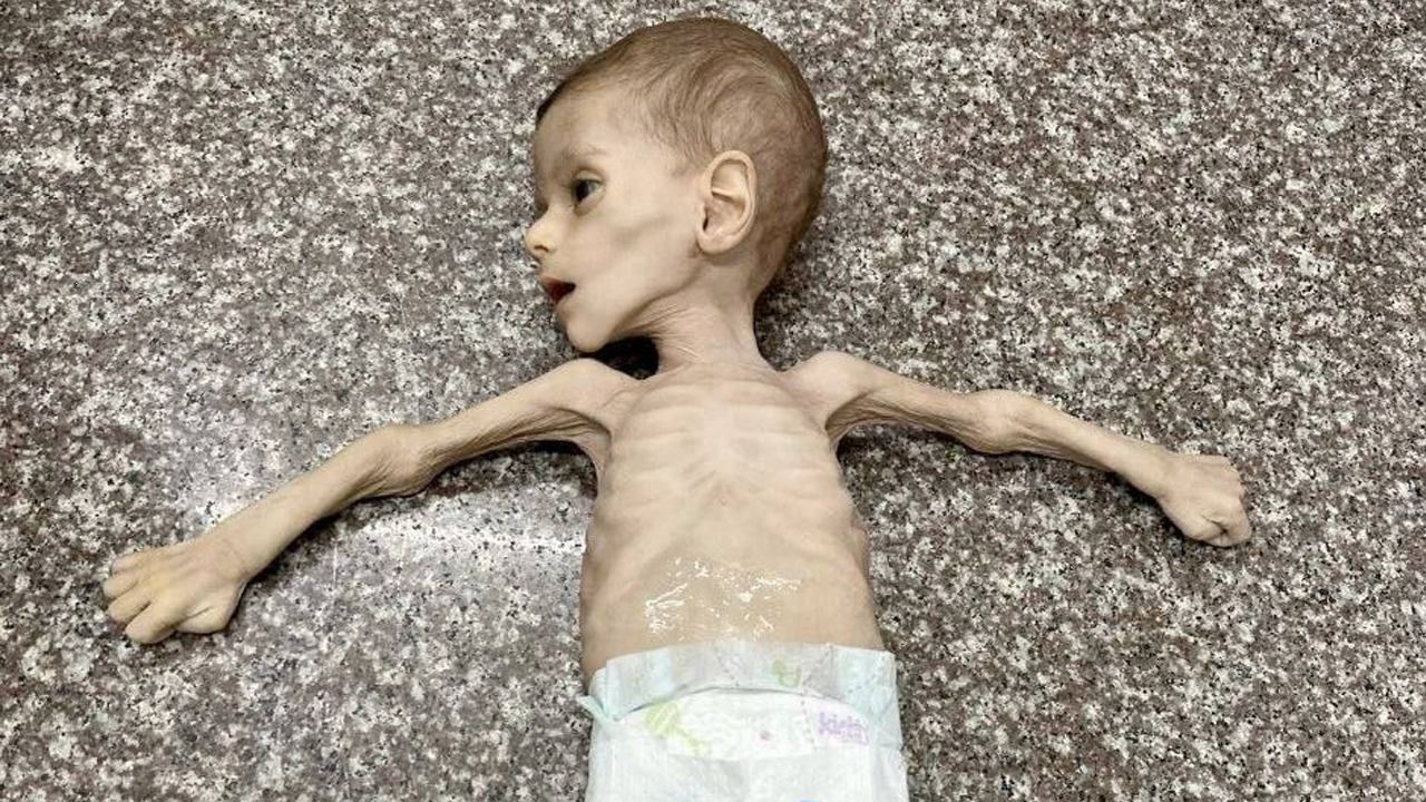 'Gazze'de 48 saat içinde 14 bin bebek ölebilir!'