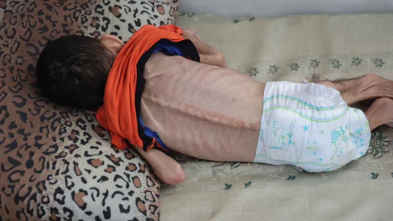 Gazze'de açlık alarm veriyor!