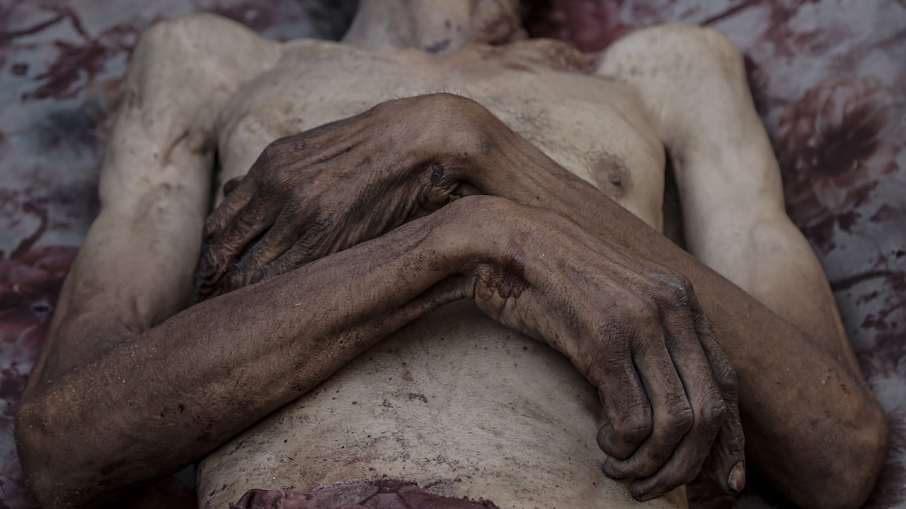 Gazze’de açlık krizi derinleşiyor! Son 24 saatte 6 kişi hayatını kaybetti