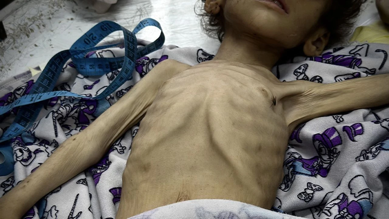 Gazze’de açlık nedeniyle 4 kişi daha can verdi!