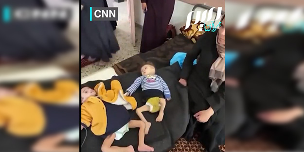 Gazze'de açlıkla savaşan bebeklerin görüntüleri yürek sızlattı!