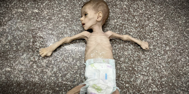 Gazze'de bir bebek daha açlıktan can verdi! 2 Milyar Müslüman film izler gibi izliyor